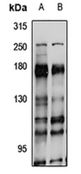 CDC2L5 Rabbit Polyclonal Antibody