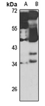 CD5L Rabbit Polyclonal Antibody