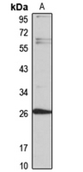 CCDC70 Rabbit Polyclonal Antibody