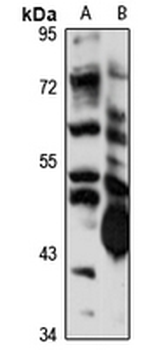 CBLL1 Rabbit Polyclonal Antibody