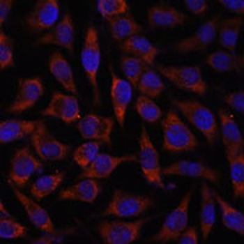 BZW2 Rabbit Polyclonal Antibody