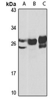 BIRC8 Rabbit Polyclonal Antibody