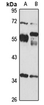 BCDIN3D Rabbit Polyclonal Antibody