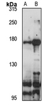 ATP10A Rabbit Polyclonal Antibody