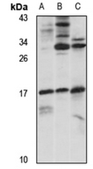 ARPC5L Rabbit Polyclonal Antibody