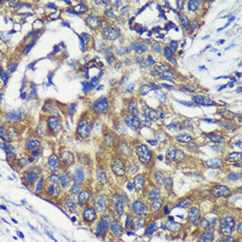 ARPC5L Rabbit Polyclonal Antibody