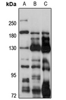 AP3B2 Rabbit Polyclonal Antibody