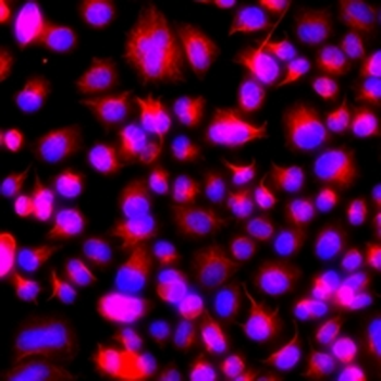 ALG1 Rabbit Polyclonal Antibody