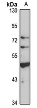 ALDH5A1 Rabbit Polyclonal Antibody