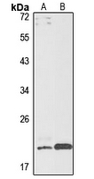 AGA Rabbit Polyclonal Antibody
