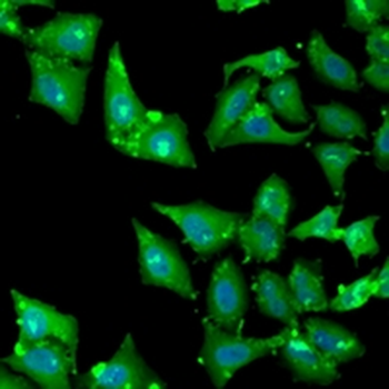 AGA Rabbit Polyclonal Antibody