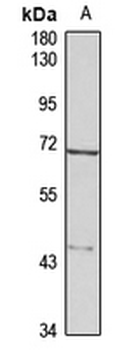 Tenr Rabbit Polyclonal Antibody