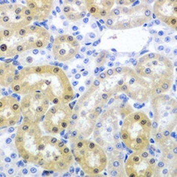 Tenr Rabbit Polyclonal Antibody