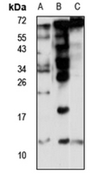 ACYP2 Rabbit Polyclonal Antibody
