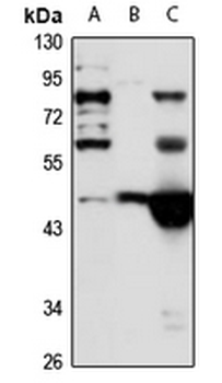 A4GALT Rabbit Polyclonal Antibody