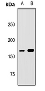 UACA Rabbit Polyclonal Antibody