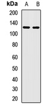 KIFC3 Rabbit Polyclonal Antibody