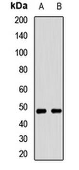 MCT11 Rabbit Polyclonal Antibody