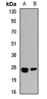 Aquaporin 8 Rabbit Polyclonal Antibody
