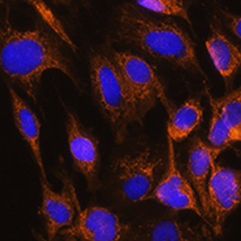 Aquaporin 8 Rabbit Polyclonal Antibody