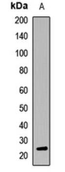 Interferon lambda-1 Rabbit Polyclonal Antibody