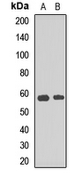 ARFGAP3 Rabbit Polyclonal Antibody