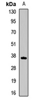 TSSK4 Rabbit Polyclonal Antibody