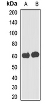 UGT3A2 Rabbit Polyclonal Antibody
