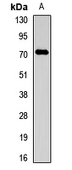 SPAG16 Rabbit Polyclonal Antibody