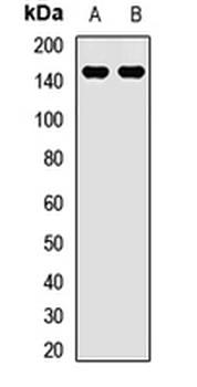 ULK4 Rabbit Polyclonal Antibody