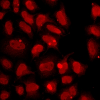 ULK4 Rabbit Polyclonal Antibody