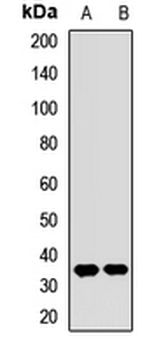 SULT1E1 Rabbit Polyclonal Antibody