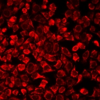 SULT1E1 Rabbit Polyclonal Antibody