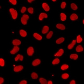IWS1 Rabbit Polyclonal Antibody