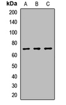 ATMIN Rabbit Polyclonal Antibody