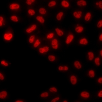 ATMIN Rabbit Polyclonal Antibody