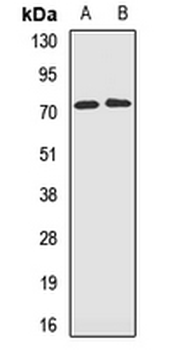 GSTCD Rabbit Polyclonal Antibody