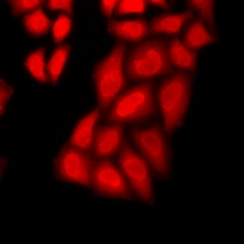 GSTCD Rabbit Polyclonal Antibody
