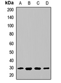 EAF2 Rabbit Polyclonal Antibody