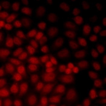 EAF2 Rabbit Polyclonal Antibody