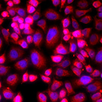 ANLN Rabbit Polyclonal Antibody
