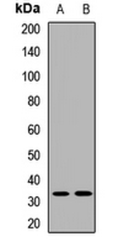 UCP1 Rabbit Polyclonal Antibody
