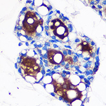 UCP1 Rabbit Polyclonal Antibody