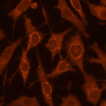UCP1 Rabbit Polyclonal Antibody