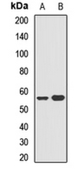 5-HT3A Rabbit Polyclonal Antibody