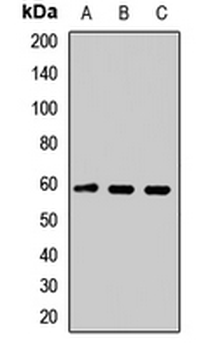 TSPYL1 Rabbit Polyclonal Antibody