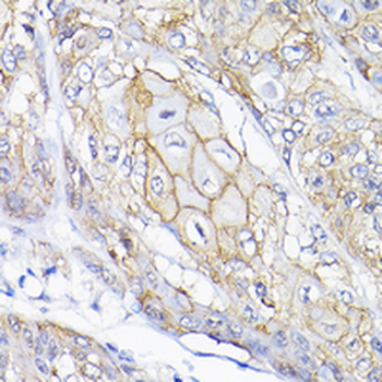 Semaphorin 4F Rabbit Polyclonal Antibody