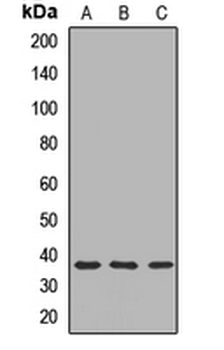 CHMP2A Rabbit Polyclonal Antibody