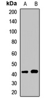 FKRP Rabbit Polyclonal Antibody