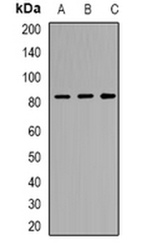 TM9SF1 Rabbit Polyclonal Antibody